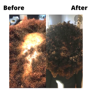 Before And After