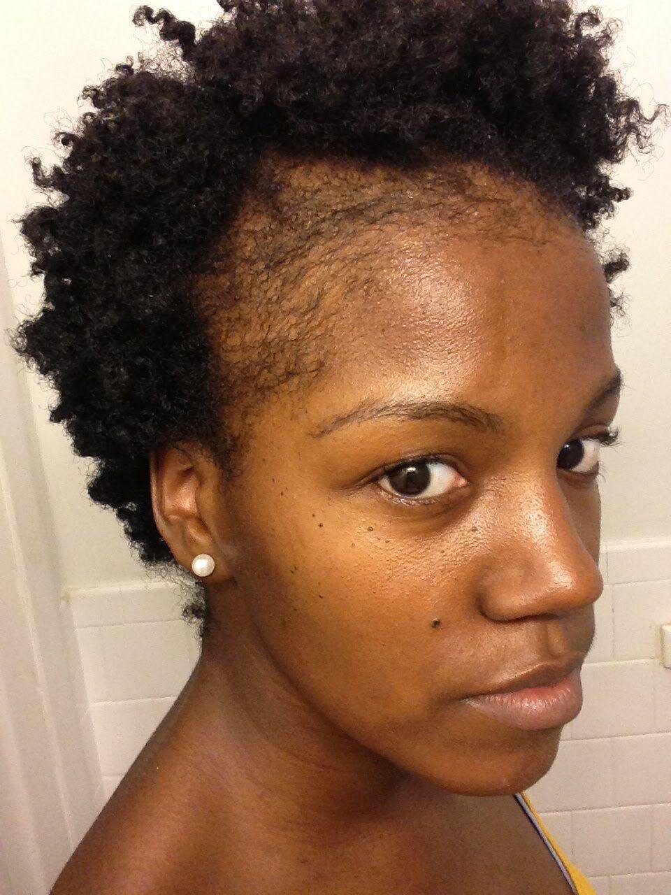 3 uncommon advice to help you recover your edges