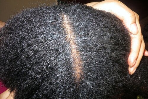Should you exfoliate your scalp?